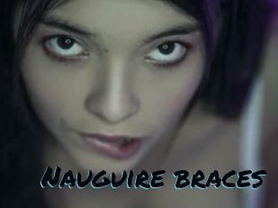 Nauguire_braces